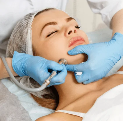 microdermabrasion
