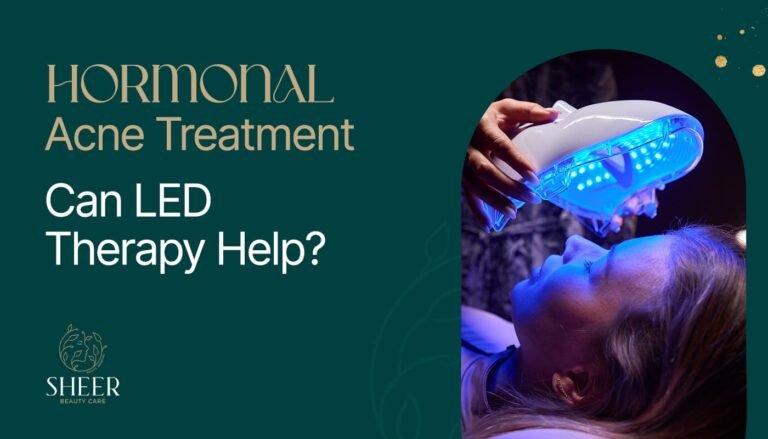 Hormonal Acne Treatment