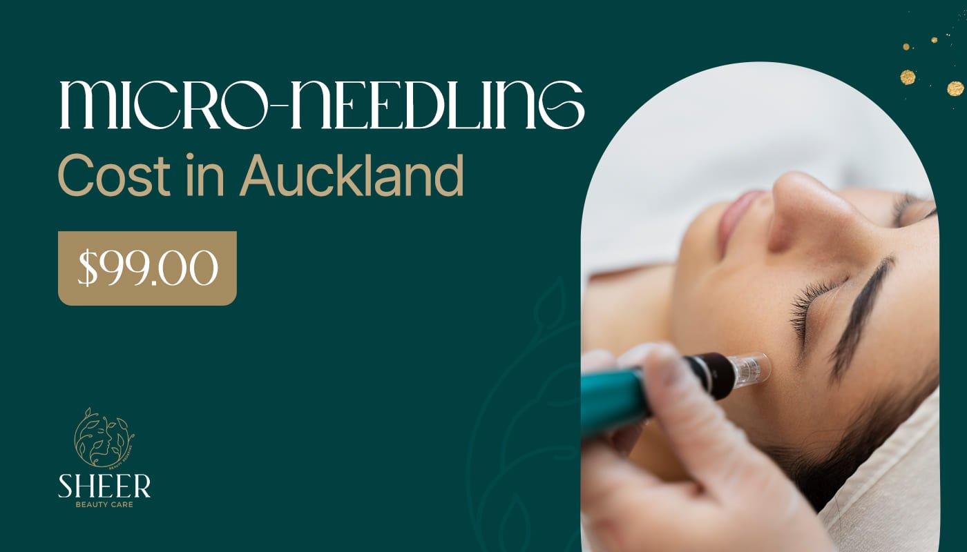Micro-Needling Cost in Auckland